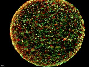 Image of Mini-Brain Photo Credit: Johns Hopkins